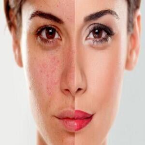  Dermatologie